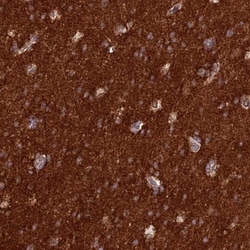ST8SIA5 Antibody, Novus Biologicals 25 &mu;L, Unlabeled:Antibodies, Polyclonal